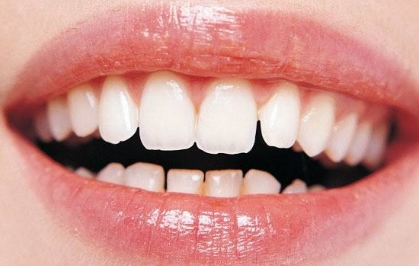 2023年武漢市性價(jià)比高的面部提拉微整形美容醫(yī)院排行榜TOP10！