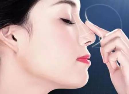 濱州眼角懸吊術(shù)醫(yī)生