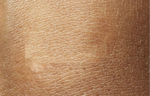 懷化溶脂去生長(zhǎng)紋醫(yī)生