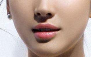 南京黃褐斑醫(yī)生