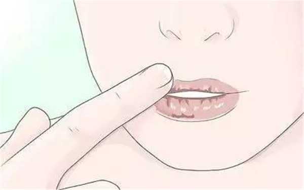 湖北動態(tài)細(xì)紋射頻去除醫(yī)生