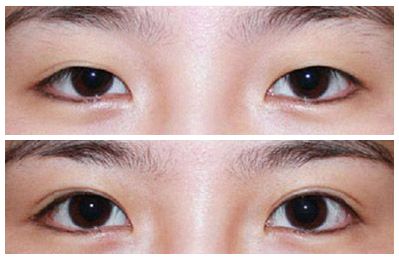 肇慶E光腿部脫毛醫(yī)生