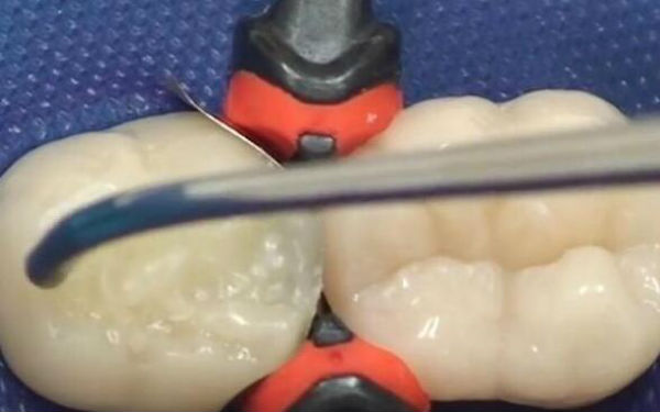 寧波下巴玻尿酸注射：2023年醫(yī)術(shù)精湛的醫(yī)院排行榜公布，這些整形醫(yī)院備受推崇！