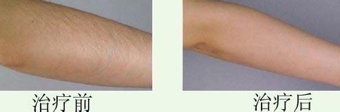 連云港哪些整形美容醫(yī)院在2023年在玻尿酸頸紋填充方面有口碑？十大排名新鮮出爐！