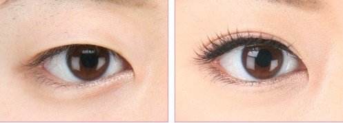 2023寧波面部提升美容排行：十家效果卓越的醫(yī)療整形醫(yī)院盤點