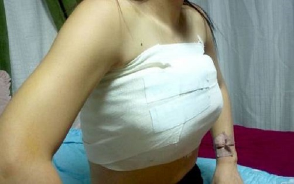 鄭州哪家整形醫(yī)院能讓您擁有完美豐唇？2023年排名前十的鄭州豐唇整形醫(yī)院是哪些？