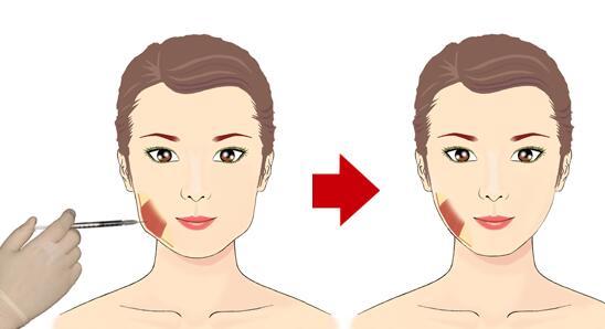 2023烏魯木齊去黑眼圈整形醫(yī)院排行榜揭曉！高性價比的醫(yī)院有哪些？