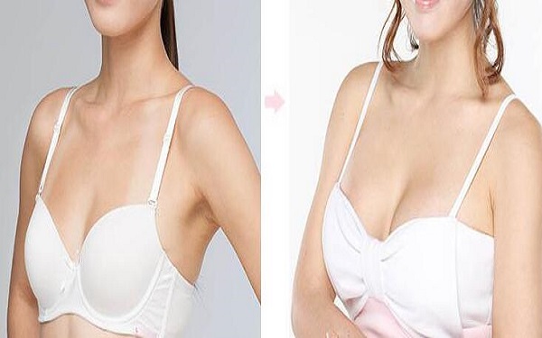 2023年深圳排名前十的靜態(tài)紋剝離醫(yī)療美容醫(yī)院推薦