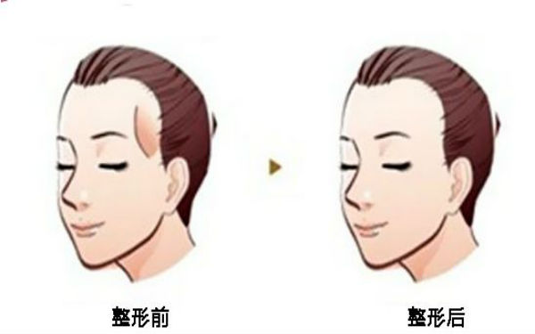 西寧顴骨矯正術(shù)：哪家醫(yī)院口碑好？2023年口碑排名前10的正規(guī)醫(yī)療整形醫(yī)院公布！