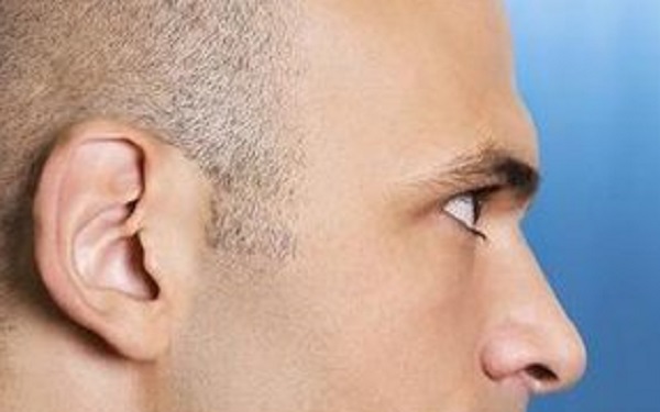 深圳哪幾家醫(yī)院能有效去除眼紋？2023年深圳比較好的眼紋去除醫(yī)院排名前十位解析！