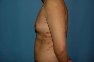 濟(jì)寧哪家醫(yī)院玻尿酸填充手術(shù)技術(shù)專(zhuān)業(yè)？2023年榜單首席整形醫(yī)院揭曉！