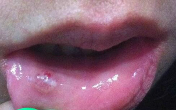 貴陽推顴骨醫(yī)生