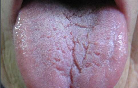 寧波瘦臉吸脂醫(yī)生