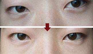 南京哪家醫(yī)院治療黃褐斑比較有口碑？2023南京微針美塑祛斑?？漆t(yī)院排行榜發(fā)布！