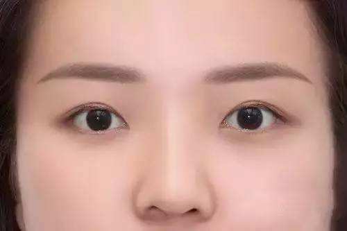 杭州面部微創(chuàng)美容手術(shù)醫(yī)生