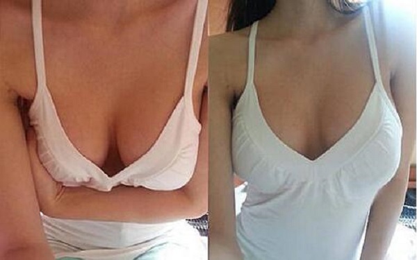 2023太原光子去咖啡斑治療醫(yī)院排行出爐！哪家醫(yī)院效果比較好