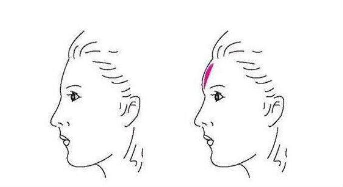 東莞十強效果明顯的肉毒素祛疤痕醫(yī)美院