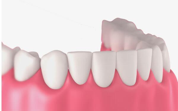 揭秘2023年溫州特色內(nèi)窺鏡額部除皺醫(yī)療美容醫(yī)院排行榜！這些醫(yī)院的名氣有多大？