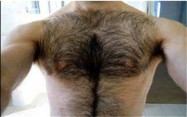 2023年寧波去唇紋排行前十強(qiáng)醫(yī)院推薦！比較正規(guī)的自體填充醫(yī)院有哪些？