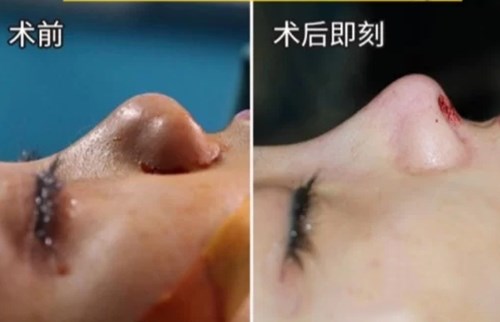 南京最熱門的環(huán)形精雕吸脂醫(yī)療美容醫(yī)院綜合推薦！2023年排行前十名大揭曉！