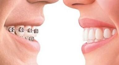 2023年鄭州高性價(jià)比的秒雕祛淚溝醫(yī)美院排名揭曉！整形美容醫(yī)院評(píng)選名單發(fā)布