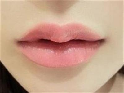 滕州哪家整形醫(yī)院祛痘印效果好？2023年前10名的微雕整容醫(yī)院找到了！