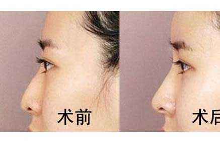 六安市受歡迎的雙眼皮整形美容醫(yī)院排行榜出爐！2023最值得信賴的明眸翹睫醫(yī)療機構(gòu)盤點！