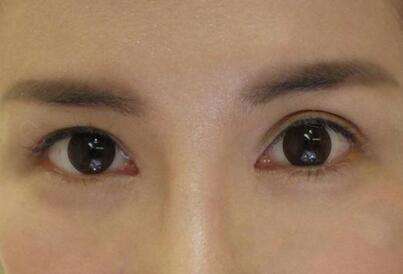 合肥抽脂填胸醫(yī)生