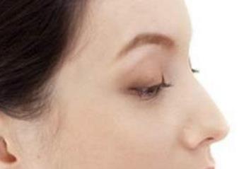 寧波玻尿酸面部精細化美學注射醫(yī)生