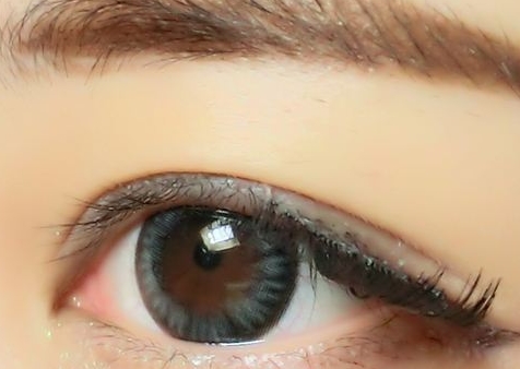 宜昌眼瞼注射填充醫(yī)生