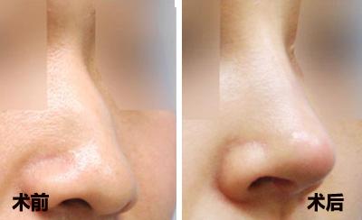 2023西寧市10家聲譽(yù)卓越的整形美容醫(yī)院，注射美白針效果非好好！