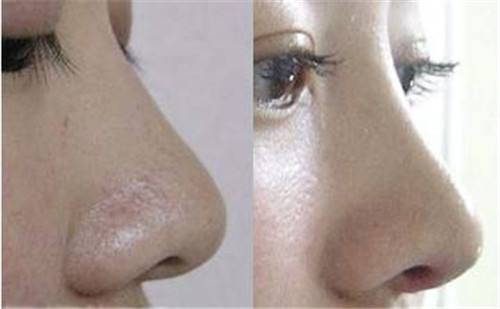 2023年北京填充川字紋凹陷醫(yī)療美容院排名前10的優(yōu)秀口碑醫(yī)院推薦，快速記錄！