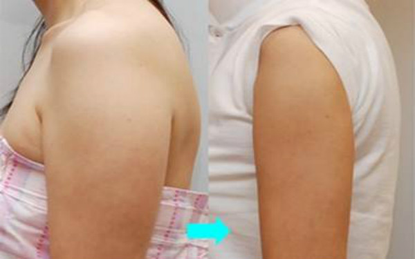 天津哪些整形美容醫(yī)院提供卓越的線雕去眼紋技術(shù)？2023比較推崇的天津線雕去眼紋前十佳整形醫(yī)院盤點(diǎn)！