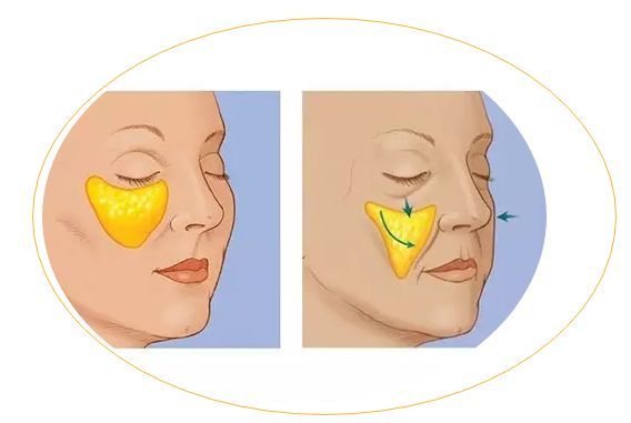 滄州哪家醫(yī)院治痘痘靠譜？推薦2023年口碑前十的權(quán)威整形美容醫(yī)院！