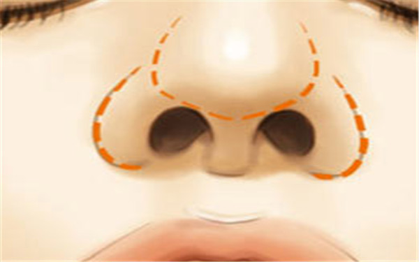 成都老年斑淡化的高級(jí)整形醫(yī)院哪家口碑比較好？最新排名公布！