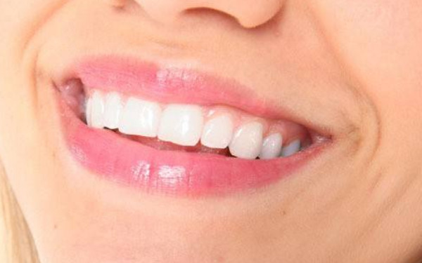 深圳醫(yī)院排行榜！2023年最值得信賴(lài)的外切法祛眼袋醫(yī)療美容名單揭曉！