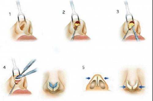 2023常德哪里可以做到去額頭紋的皮秒整形美容醫(yī)院排行榜前10強(qiáng)露面！