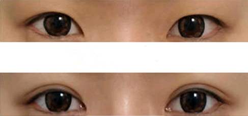 佛山口周紋有哪些醫(yī)院可以進(jìn)行活細(xì)胞治療？2023排名前10的專業(yè)機(jī)構(gòu)精選！