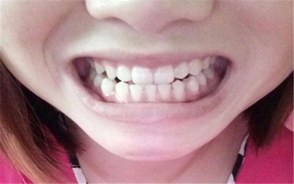 無錫水動力360°環(huán)形吸脂醫(yī)生