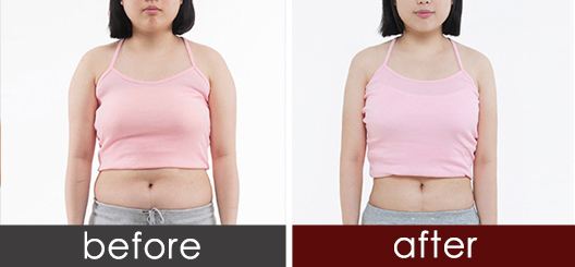 昆明切開法重瞼術(shù)醫(yī)生