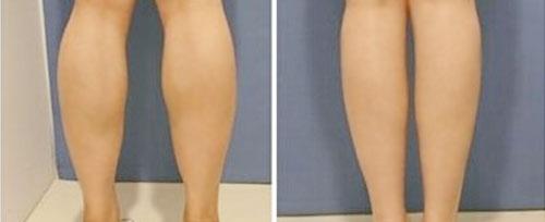 鄭州這家醫(yī)療整形院治療痘坑效果不錯(cuò)，值得推薦！2023最新排名TOP10出爐！