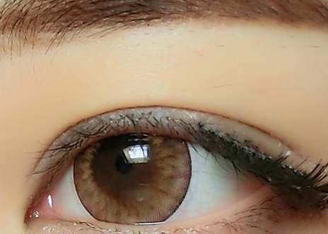 馬鞍山超皮秒去雀斑醫(yī)生