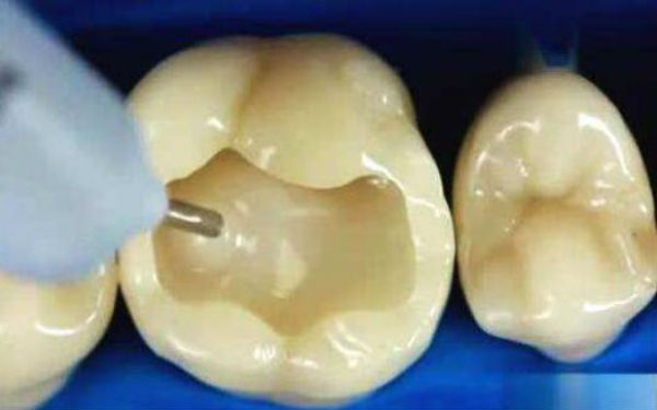 廣州哪家醫(yī)院針雕祛除眉間紋效果比較好？2023年排名前十名單揭曉！