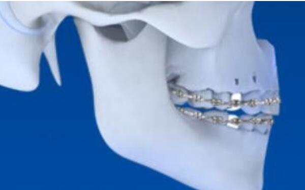 2023北京市面部整形醫(yī)院精心推薦，挑選您滿意的五官整形機(jī)構(gòu)！