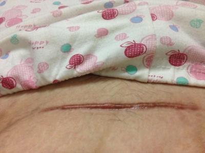 威海隆鼻手術(shù)醫(yī)生