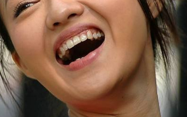 2023年達(dá)州黃金微針祛除口周紋的獨(dú)家推薦列表！榜單前10強(qiáng)達(dá)州美容整形醫(yī)院揭秘！