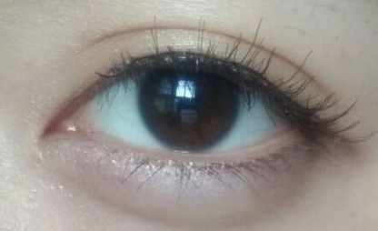 2023年強勢來襲！德州整形醫(yī)院推出全臉去痣首選，前十強榮耀問世！