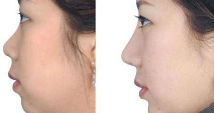 南京靜態(tài)紋醫(yī)療美容正規(guī)醫(yī)院有哪些？2023年十大排名盤(pán)點(diǎn)！