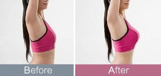 揭秘2023深圳治療抬頭紋熱門醫(yī)院排行榜top10！這些明星醫(yī)院廣受推崇，種草不斷！