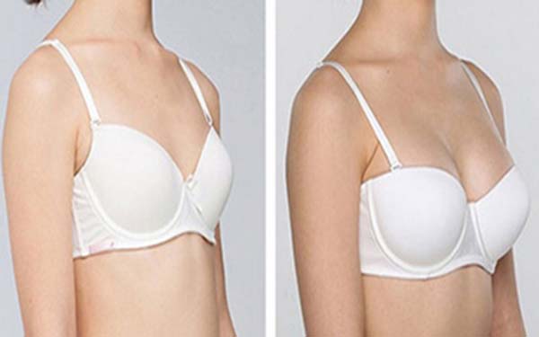 黑龍江3D精微祛眼袋醫(yī)生